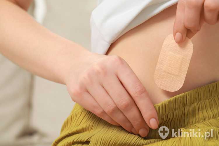 Plaster antykoncepcyjny