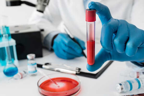 hematologia