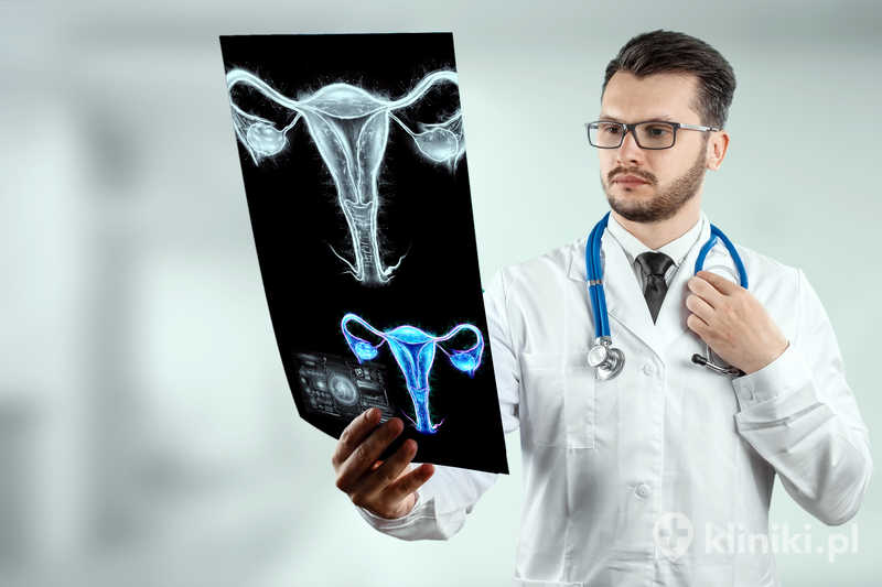 Leczenie zapalenia narządów miednicy mniejszej bywa prowadzone ambulatoryjnie lub szpitalnie