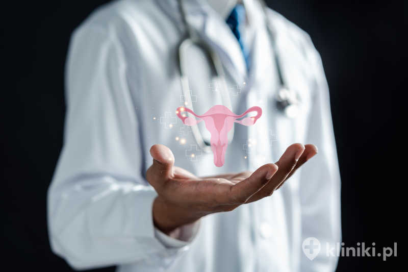Postępowanie terapeutyczne w PCOS może zmniejszać objawy hiperandrogenizmu. Postępowanie terapeutyczne w PCOS może zmniejszać objawy hiperandrogenizmu.