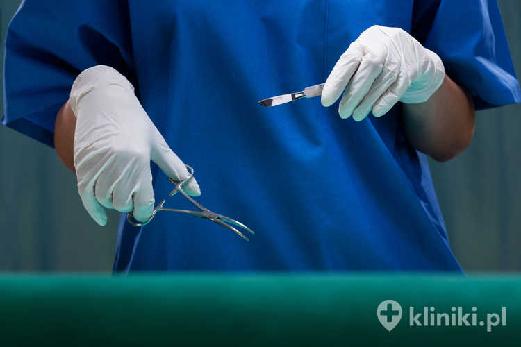 Zmiany skórne kwalifikuje się do wycięcia operacyjnego, jeśli szybko rosną, zmieniają kształt, kolor lub zaczynają krwawić