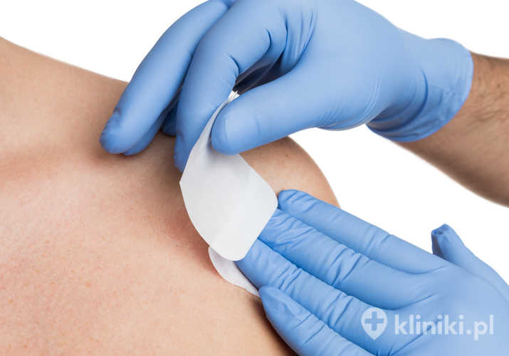 Zmiany skórne wymagają oceny specjalisty, który decyduje o konieczności leczenia chirurgicznego na podstawie badania klinicznego i wyników diagnostyki