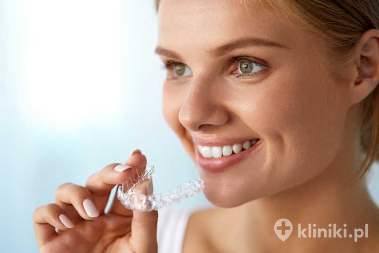 Rodzaje aparatów ortodontycznych dobiera się w zależności od rodzaju wady zgryzu, wieku i preferencji estetycznych pacjenta