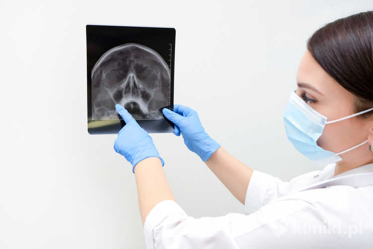 Przebieg operacji FESS