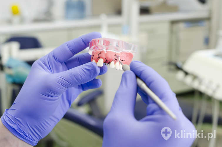 Przeciwwskazania do implantu zęba