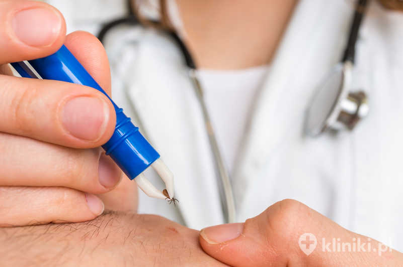 Rozpoznanie boreliozy i infekcji odkleszczowych może wymagać wykonania testów serologicznych Rozpoznanie boreliozy i infekcji odkleszczowych może wymagać wykonania testów serologicznych