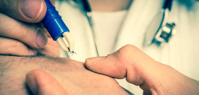 Borelioza – objawy, diagnoza i skuteczne metody leczenia