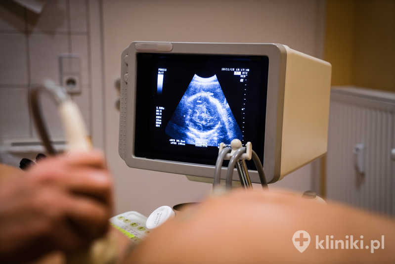 Leczenie kiły wymaga regularnych kontroli i badań serologicznych Leczenie kiły wymaga regularnych kontroli i badań serologicznych