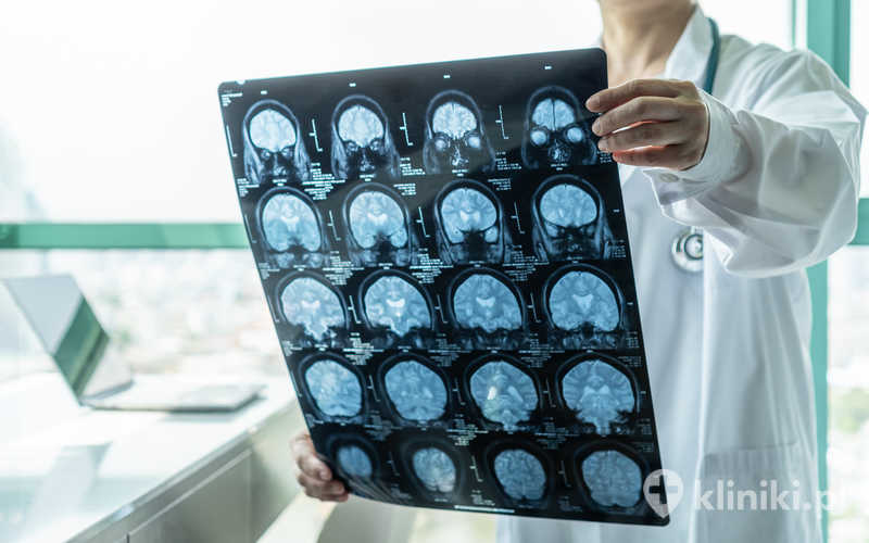 Rezonans magnetyczny –  przeciwwskazania