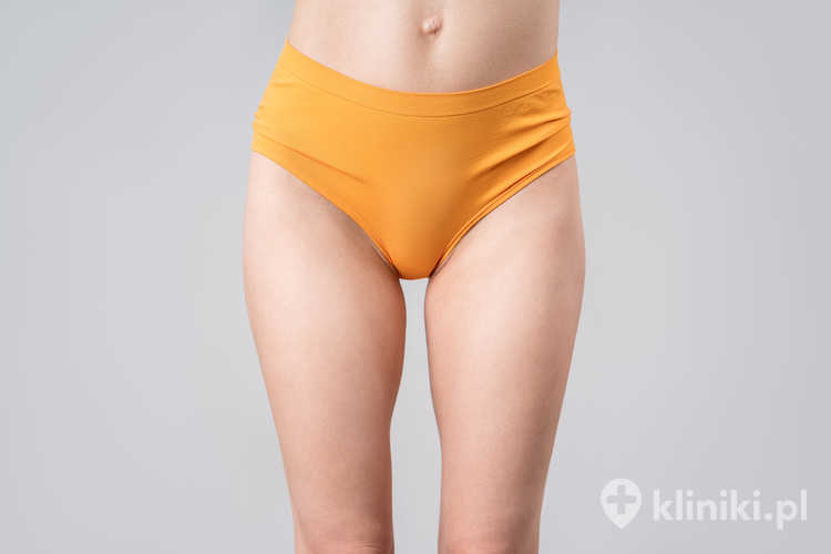 Prosaki okolic intymnych powstają w wyniku zatrzymania keratyny w ujściu mieszka włosowego lub gruczołu łojowego