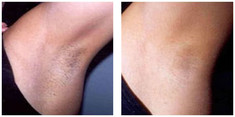 Zabiegi kosmetologiczne przed i po zabiegu