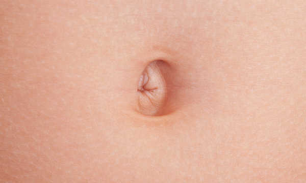 Przepuklina pępkowa w ciąży - jak wygląda?