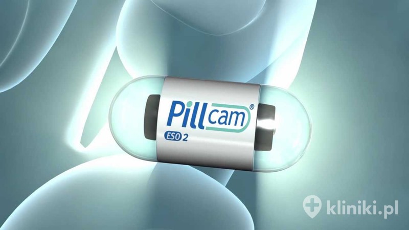 Kapsułki endoskopowe PillCam Eso