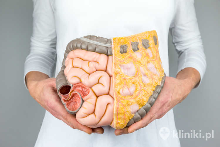 Kolonografia TK, określana także jako wirtualna kolonoskopia, jest dobrze tolerowana przez pacjentów i nie wymaga sedacji