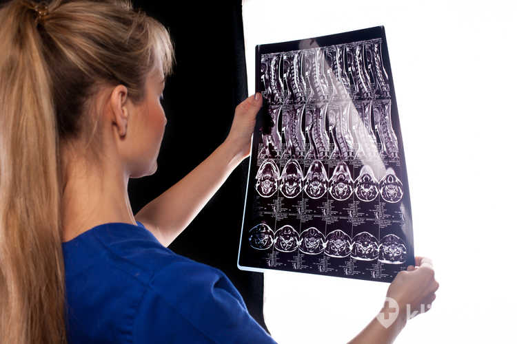 Obrazowanie kręgosłupa metodą MRI może ujawnić guzy, infekcje i zmiany zapalne