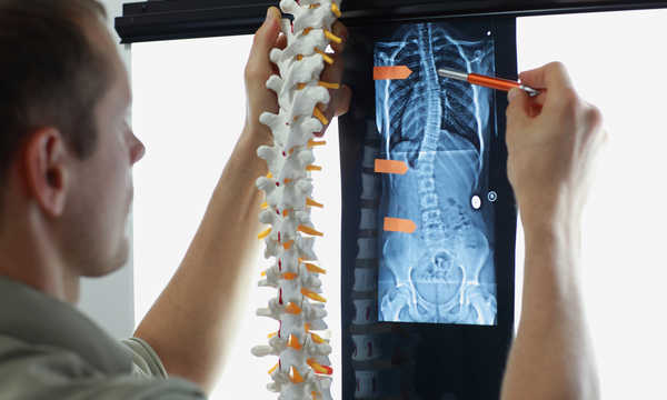 Rezonans magnetyczny kręgosłupa dokładnie obrazuje kręgi, dyski i struktury nerwowe