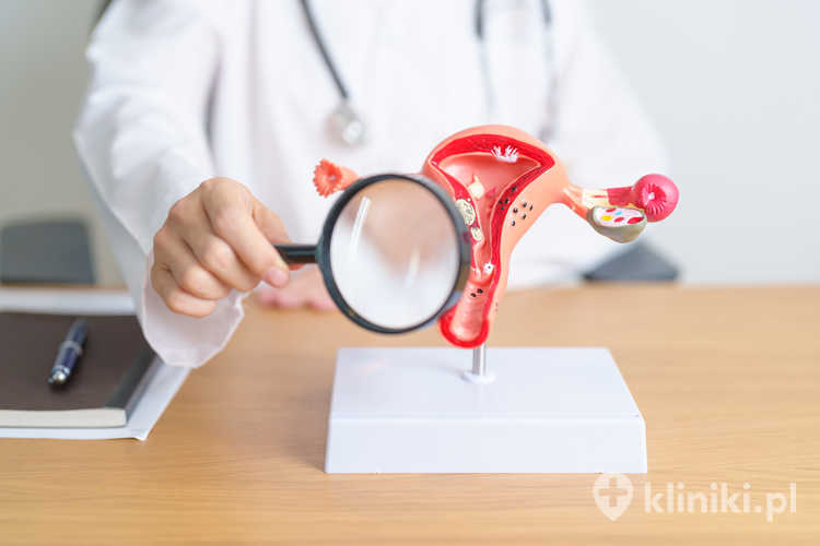 Terapia rozrostu endometrium najczęściej opiera się na stosowaniu progestagenów, które hamują nadmierny rozrost błony śluzowej macicy