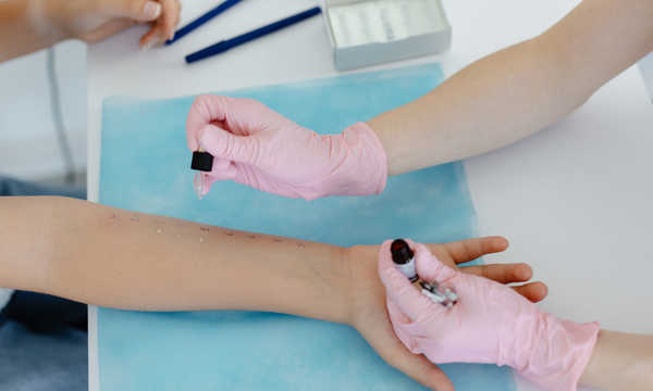Praca alergologa obejmuje rozpoznawanie przyczyn reakcji alergicznych