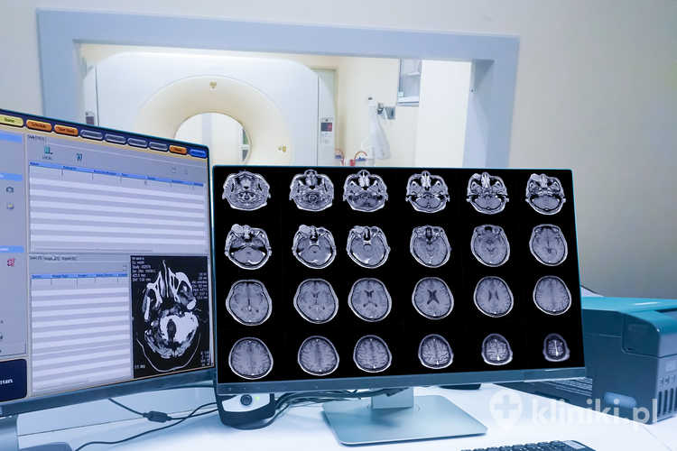 Przygotowanie do tomografii z kontrastem powinno uwzględniać zalecenia pracowni.