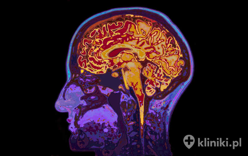 Funkcjonalny rezonans magnetyczny mózgu umożliwia analizę zmian przepływu krwi związanych z pracą neuronów