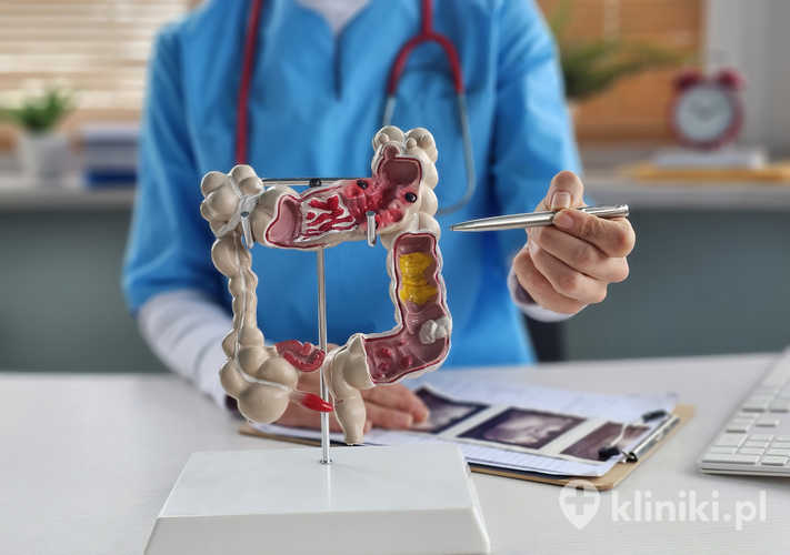 Do jakiego lekarza z hemoroidami?
