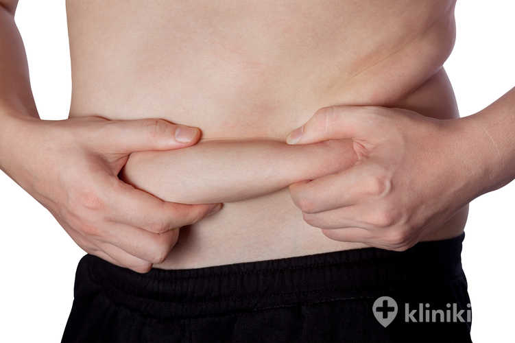 Liposukcja brzucha