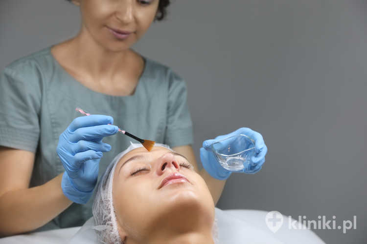 Peeling chemiczny twarzy