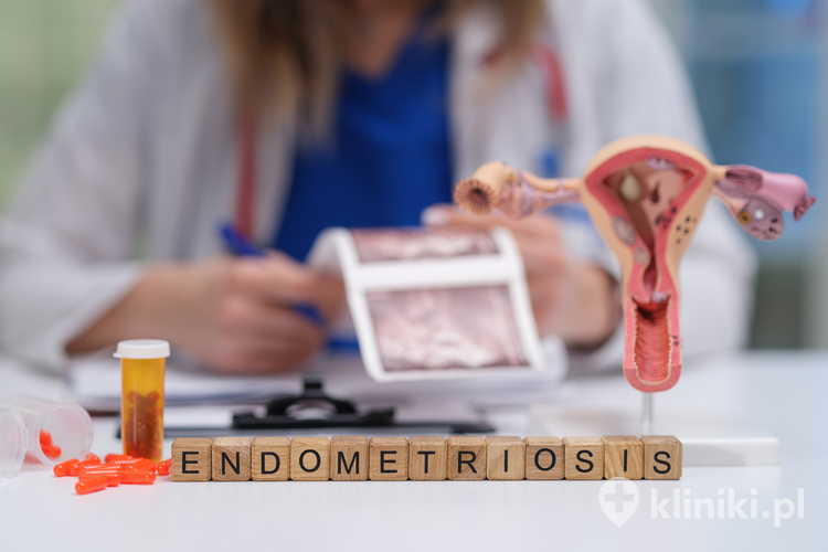 Co to jest endometrioza?