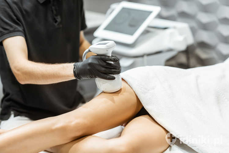 Liposukcja ultradźwiękowa może powodować przejściowy obrzęk, zasinienie i ból