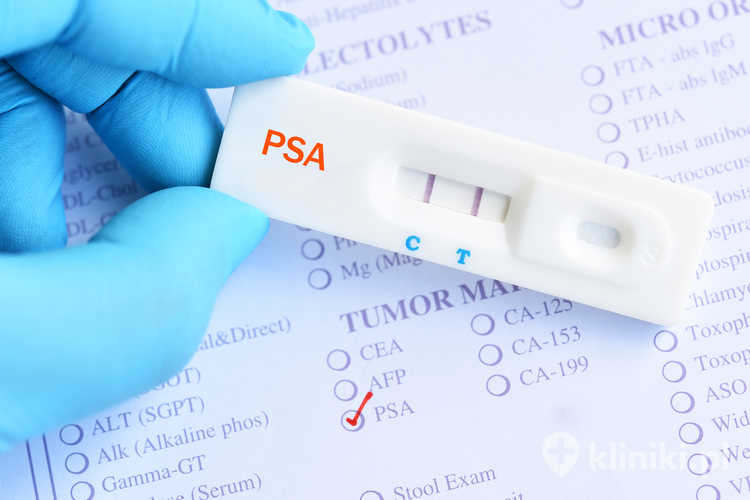 Test na raka prostaty