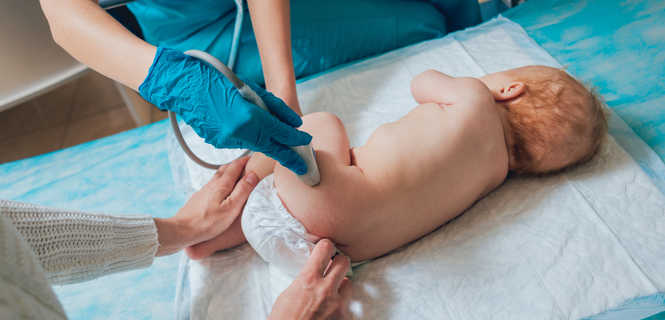 USG stawów biodrowych u niemowląt (i dzieci)