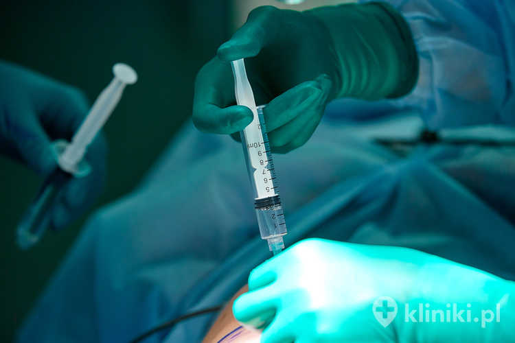 Znieczulenie ogólne przed liposukcją brzucha