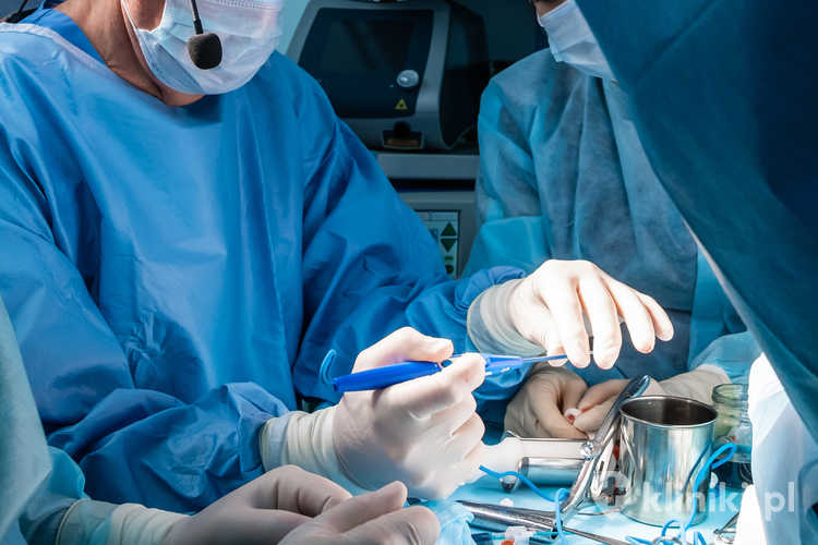 Terapia hemoroidów może obejmować gumkowanie, skleroterapię lub koagulację podczerwienią