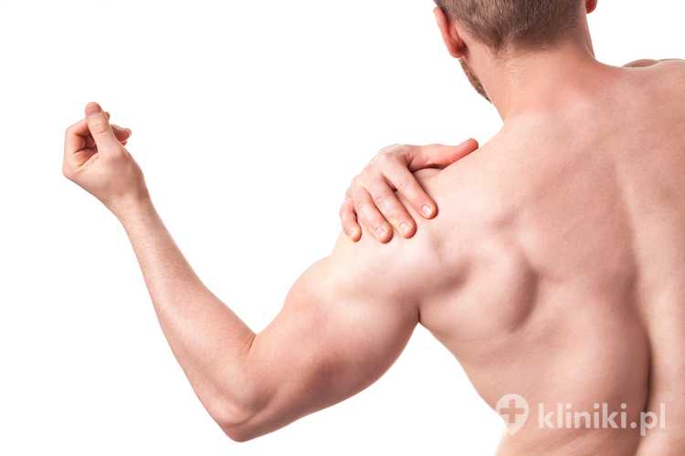 Kontuzja barku po ciężkim treningu na siłowni