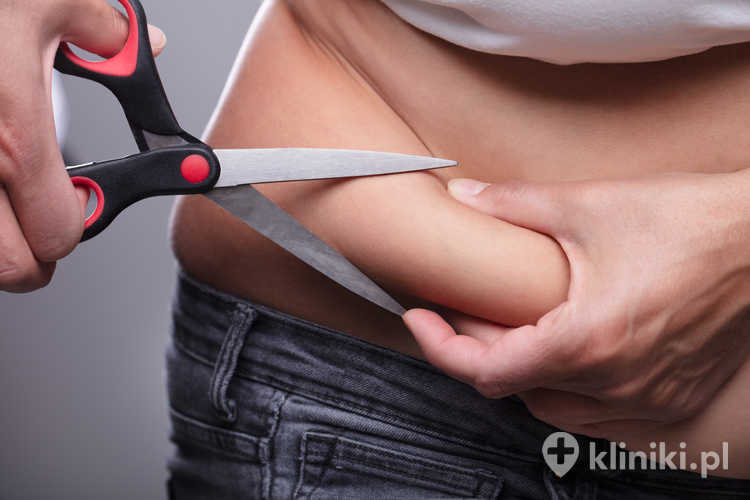 Obfita tkanka tłuszczowa na brzuchu - przed zabiegiem abdominoplastyki