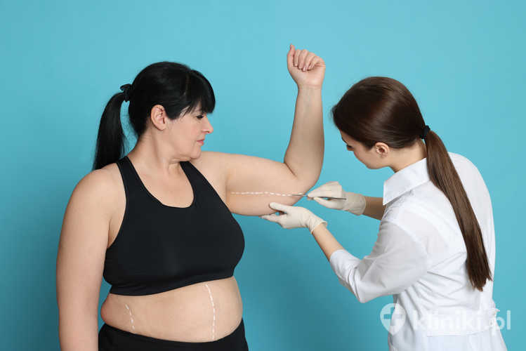 Chirurg plastyczny konsultuje się z kobietą przed zabiegiem liposukcji