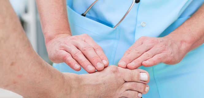 Haluksy - czy można je leczyć bez operacji?