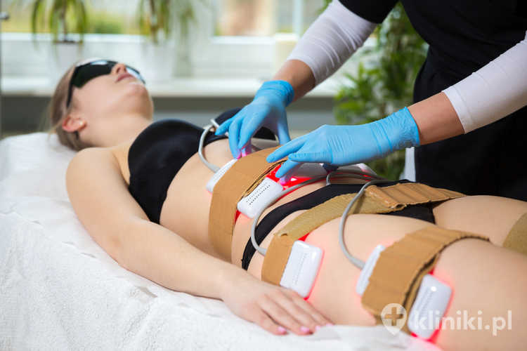 Kobieta poddawana odchudzającej terapii laserem lipo w spa
