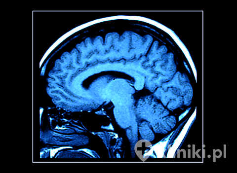 Wskazania do rezonansu magnetycznego głowy obejmują przewlekłe lub nasilające się bóle głowy, zwłaszcza gdy towarzyszą im objawy neurologiczne
