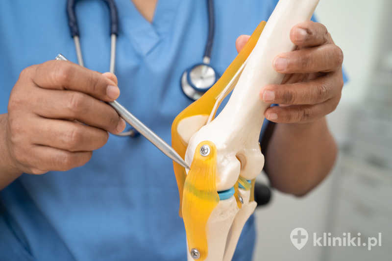 Choroba zwyrodnieniowa stawu kolanowego, lekarz trzymający model anatomii ortopedycznej ludzkiego stawu kolanowego w szpitalu Choroba zwyrodnieniowa stawu kolanowego, lekarz trzymający model anatomii ortopedycznej ludzkiego stawu kolanowego w szpitalu