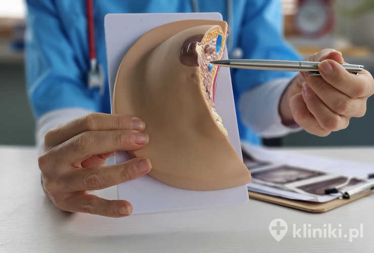Lekarz wyjaśnia chorobę i wykorzystuje anatomiczny model koncepcji piersi