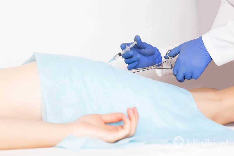 Lekarz wykonuje operację usunięcia hemoroidów Lekarz wykonuje operację usunięcia hemoroidów