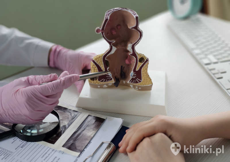 Ludzki model anatomiczny odbytnicy - lekarz pokazuje pacjentowi hemoroidy Ludzki model anatomiczny odbytnicy - lekarz pokazuje pacjentowi hemoroidy