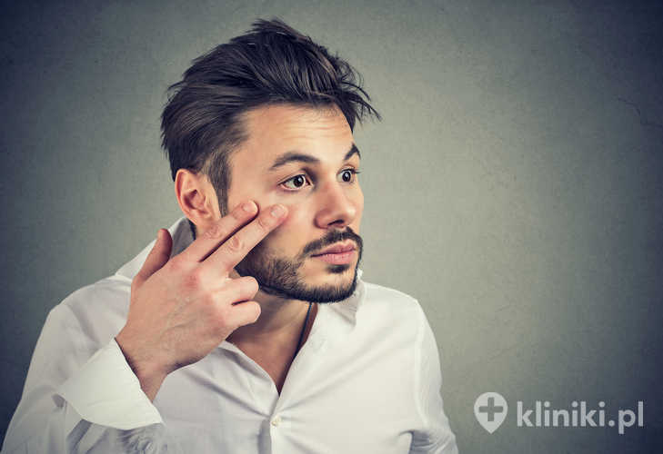 Mężczyzna zastanawia się nad zabiegiem kantopeksji