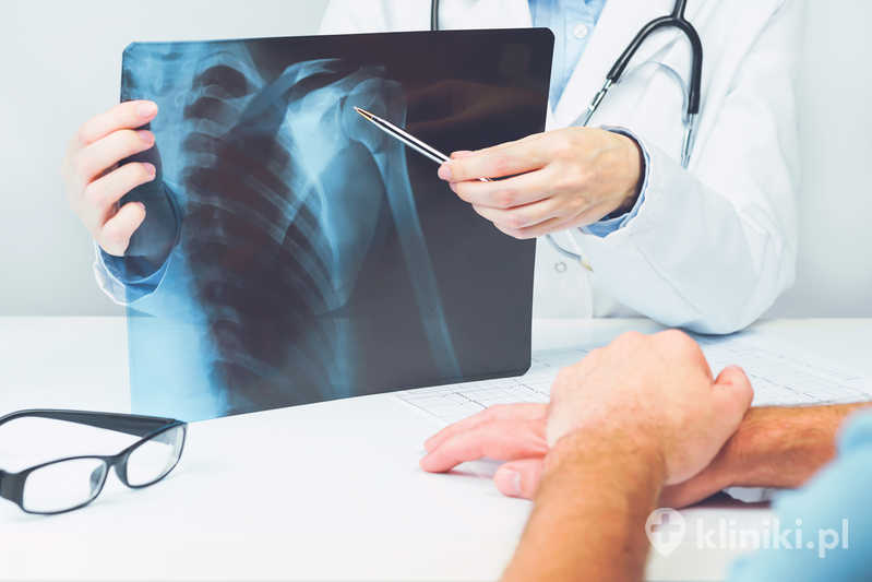 Przygotowanie do operacji barku wymaga wykonania badań oraz odbycia konsultacji z lekarzem