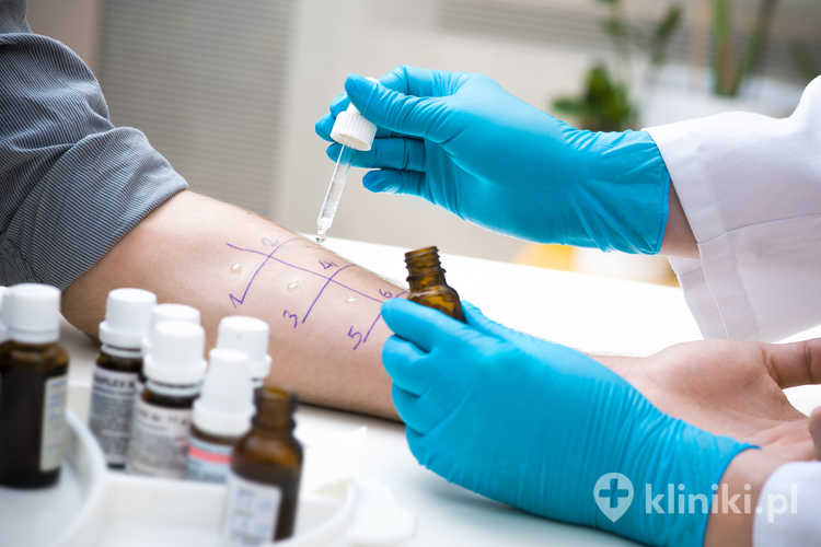 Test na alergię skórną na silikon
