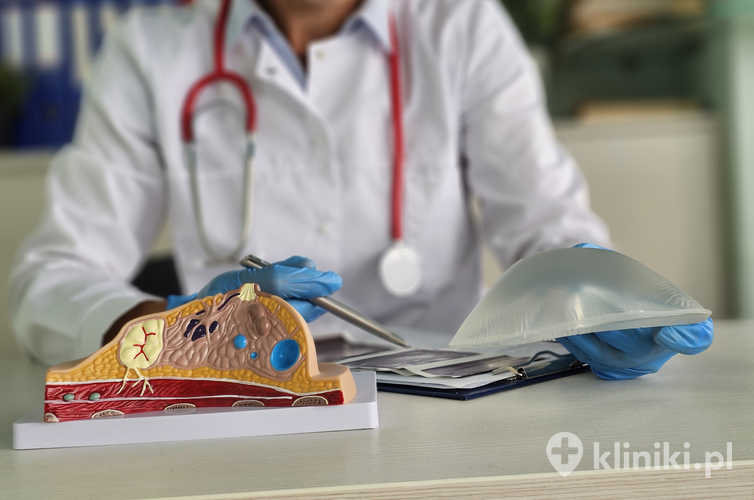 Koncepcja usunięcia implantów silikonowych