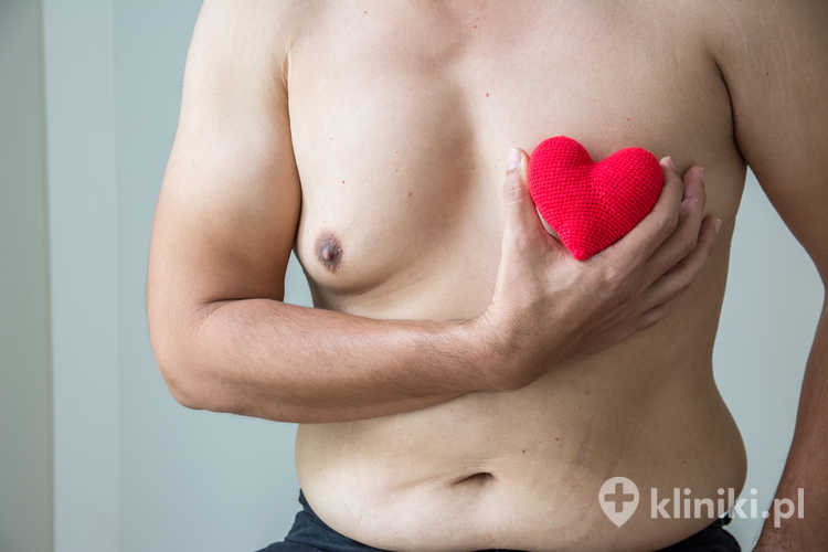 Mężczyzna z widoczną ginekomastią tłuszczową