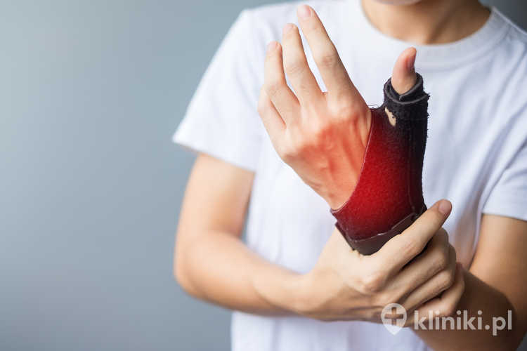 Rehababilitacja po operacji choroby De Quervaina