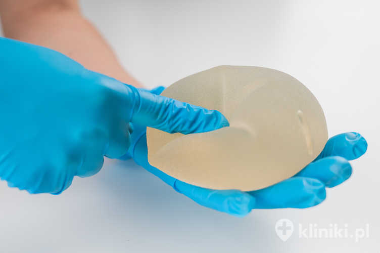 Chirurg plastyczny pokazuje silikonowy implant piersi